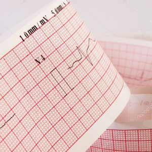 Papier d'impression ecg médicaux médical